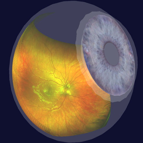 Ultra-Widefield Retinal Imaging